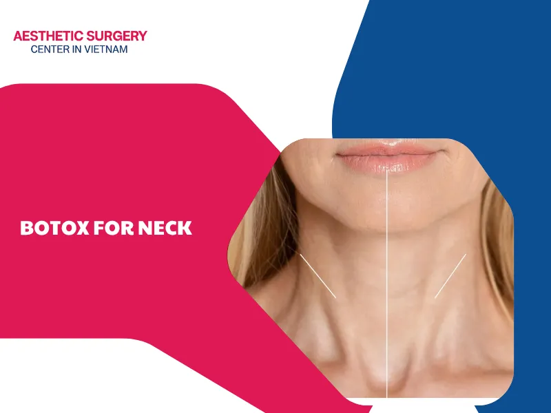Botox for neck: Understanding the procedure and costs