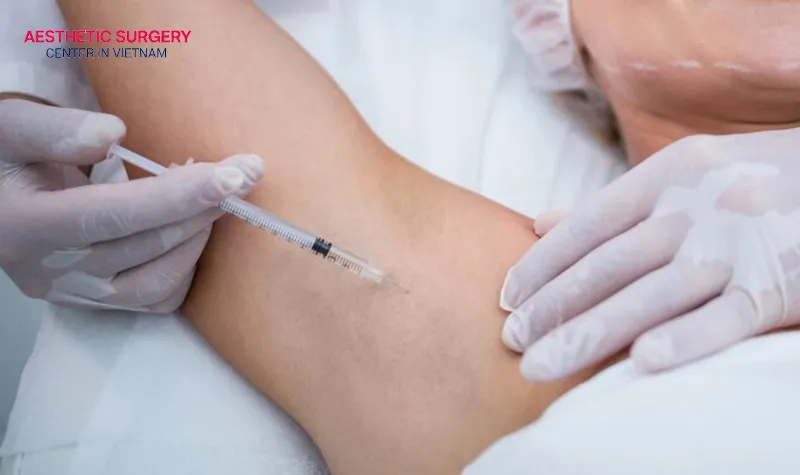Botox injections for sweating are widely preferred because of their many advantages.