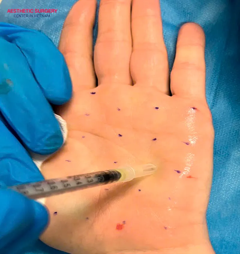 The treated area will become dry immediately and give you greater confidence.