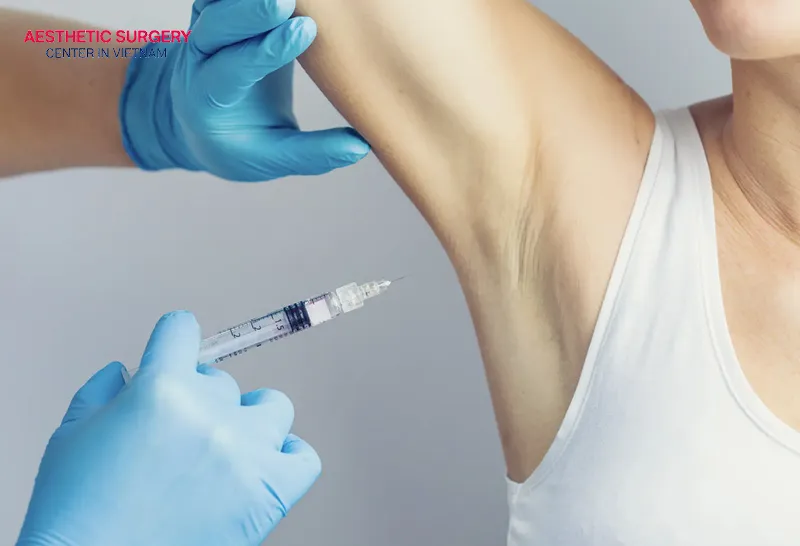 Botox injections in the armpits to reduce sweating are favored by many individuals.