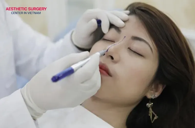 A botox nose lift is an effective beauty method that is non-invasive.