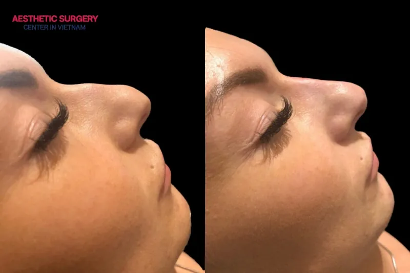 You will see the best results after 2 weeks.