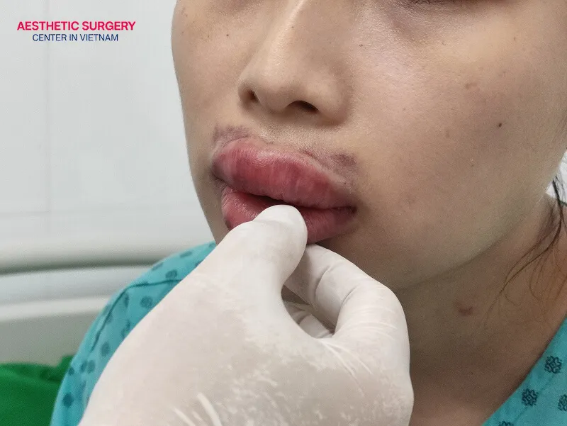 You should seek medical examination immediately if there are abnormal symptoms.