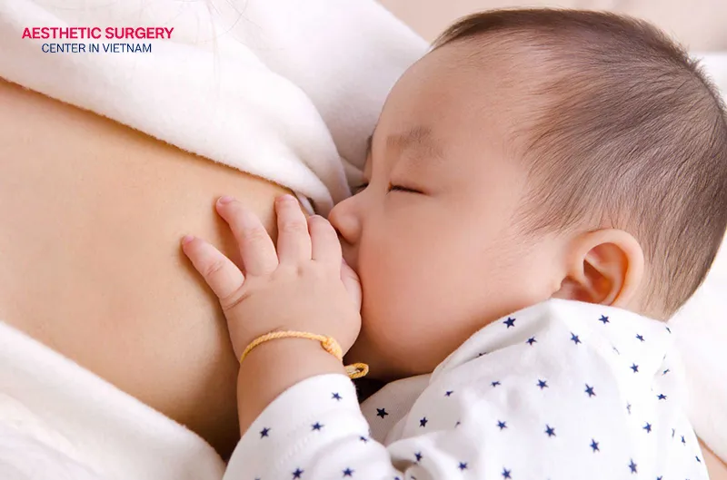 You need to carefully consider getting botox while breastfeeding.