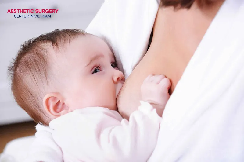 You should carefully consider getting botox while breastfeeding.