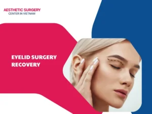 Eyelid surgery recovery timeline: Step-by-step instructions