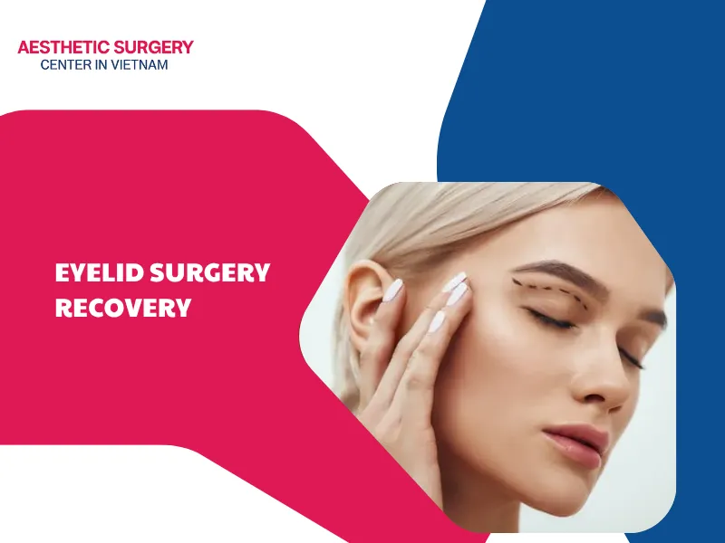 Eyelid surgery recovery timeline: Step-by-step instructions