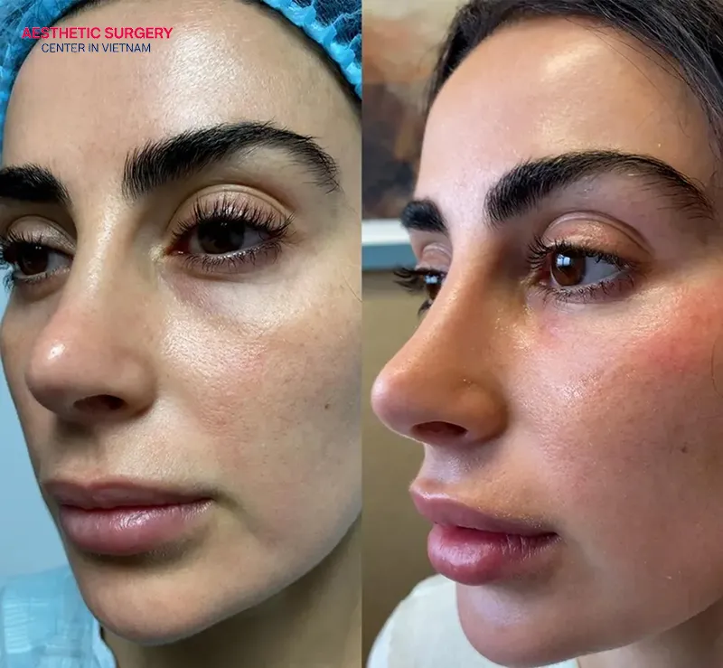 The face becomes more refreshed and vibrant.