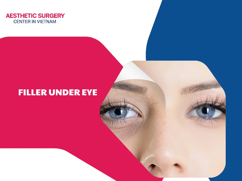 What is filler under eye? Should you choose it?