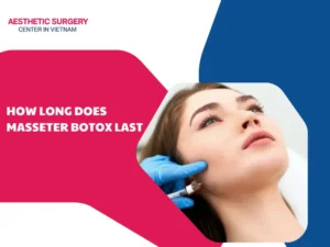 How long does masseter botox last? Factors affecting the results