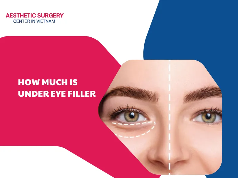 Question and answer: How much is under eye filler?