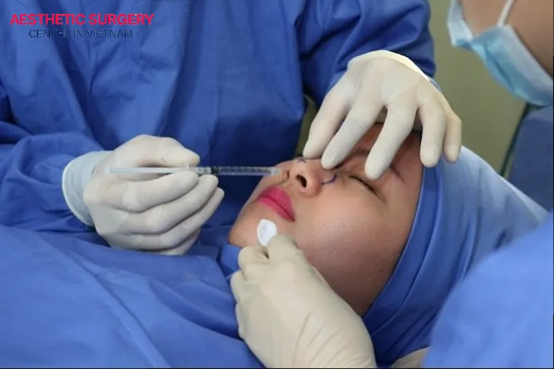 Local anesthesia in the nasal area ensures the client feels no pain during the surgery