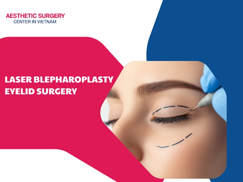 What is laser blepharoplasty eyelid surgery? Procedure and costs
