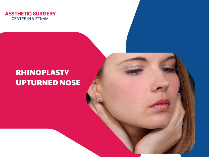 rhinoplasty upturned nose