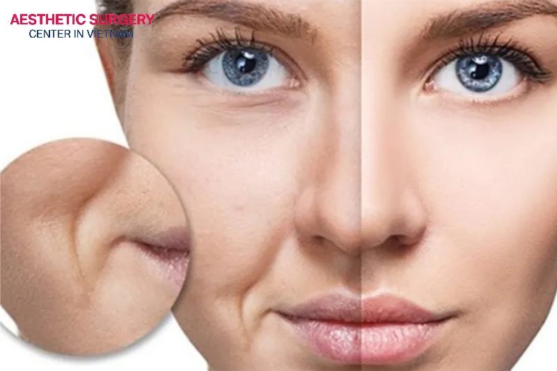 The two sides of the face are asymmetrical, one side fuller than the other