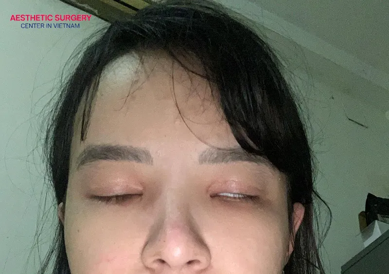 Eyelid malposition is a technical issue that needs to be corrected