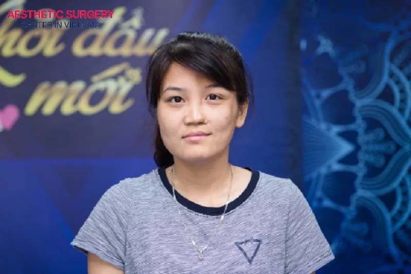 Individuals with residual deformities such as drooping nasal wings, a short columella, or uneven nostrils are suitable candidates for rhinoplasty cleft palate.