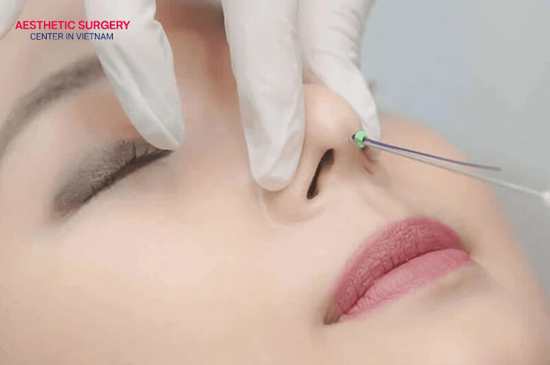 You may experience unwanted aesthetic complications if rhinoplasty is performed at a low-quality facility.