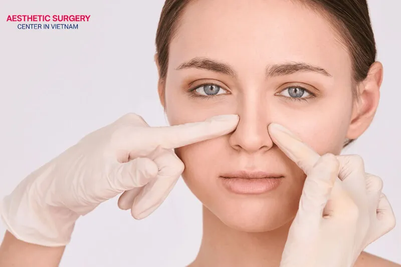 Trauma is the most common cause of saddle nose deformity.