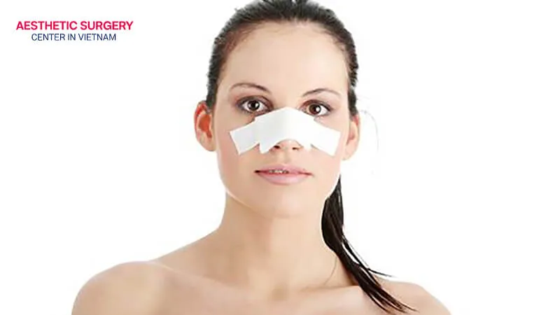 The nose is stabilized to maintain its shape during the initial postoperative period.