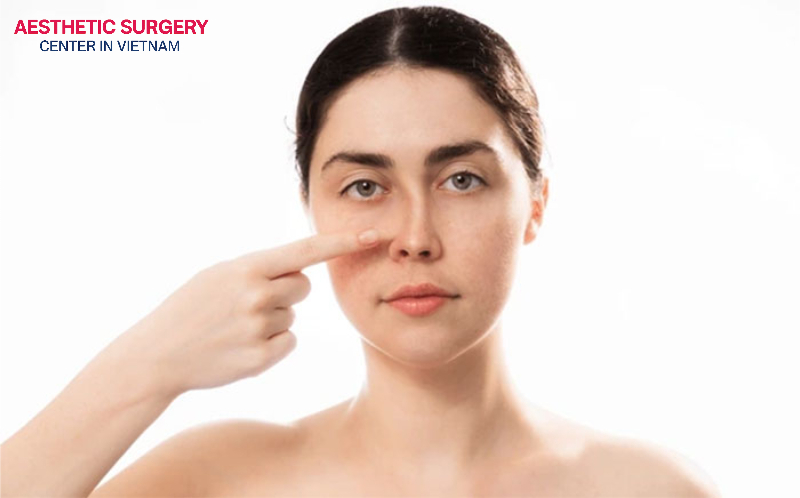 A crooked nose can be caused by chronic nasal inflammatory conditions such as sinusitis and allergic rhinitis.