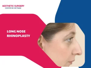 What is long nose rhinoplasty? Process and cost