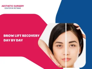 Brow lift recovery day by day: Tips for a successful process