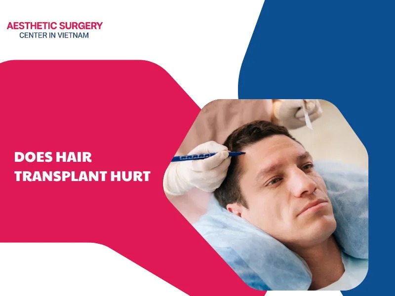 Does hair transplant hurt? Causes and how to reduce pain