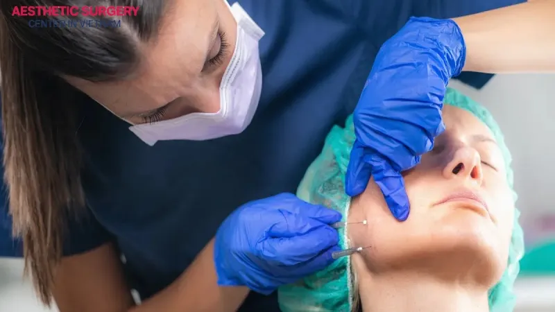 The chin botox procedure is performed in 4 steps