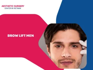 Brow lift men: What to know about benefits, cost and recovery