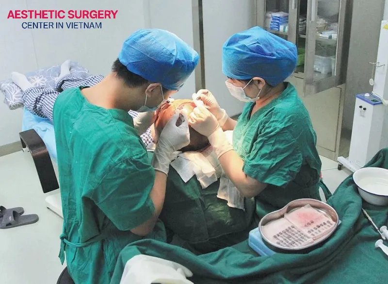 Hair transplants performed by highly skilled and experienced professionals will be more expensive.