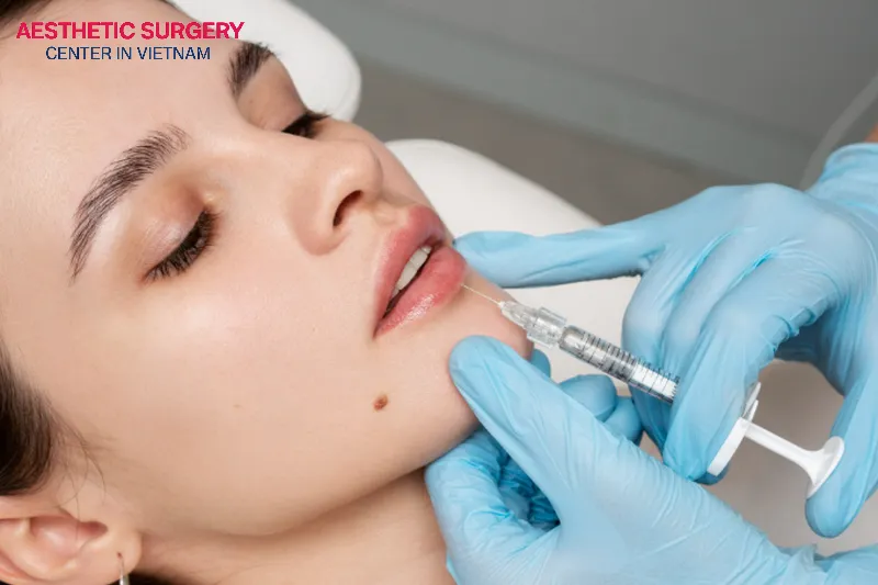 Whether or not filler injections are painful depends on the skill of the person performing the injection