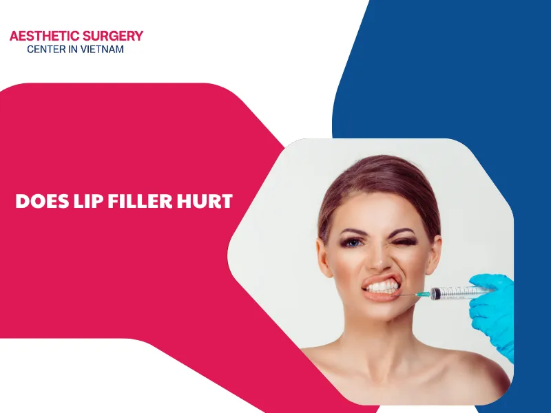 Does lip filler hurt? Factors affecting the level of discomfort
