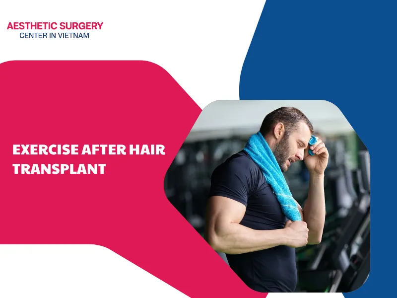 Can you exercise after hair transplant? Safe training methods
