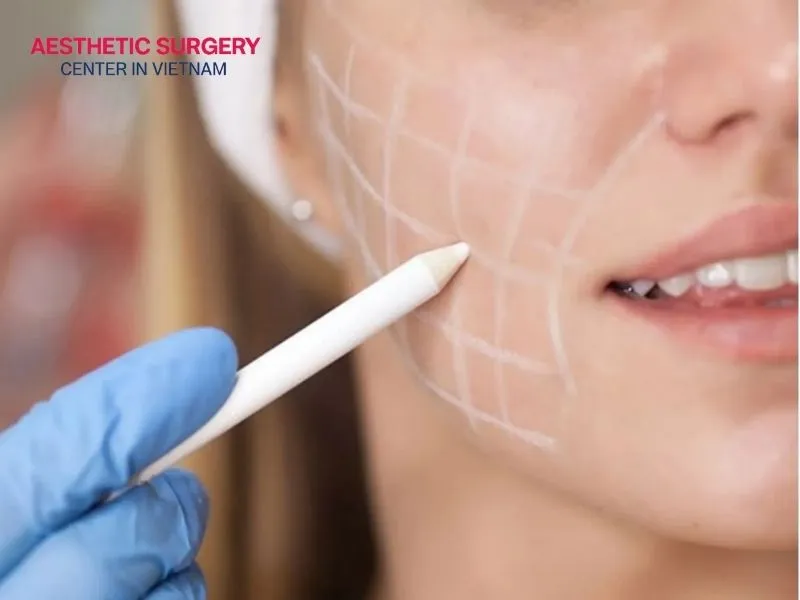 Facial liposuction is a modern cosmetic procedure that quickly removes fat from the cheek area.