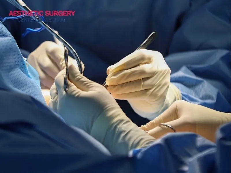 The cost of liposuction face depends on several factors.