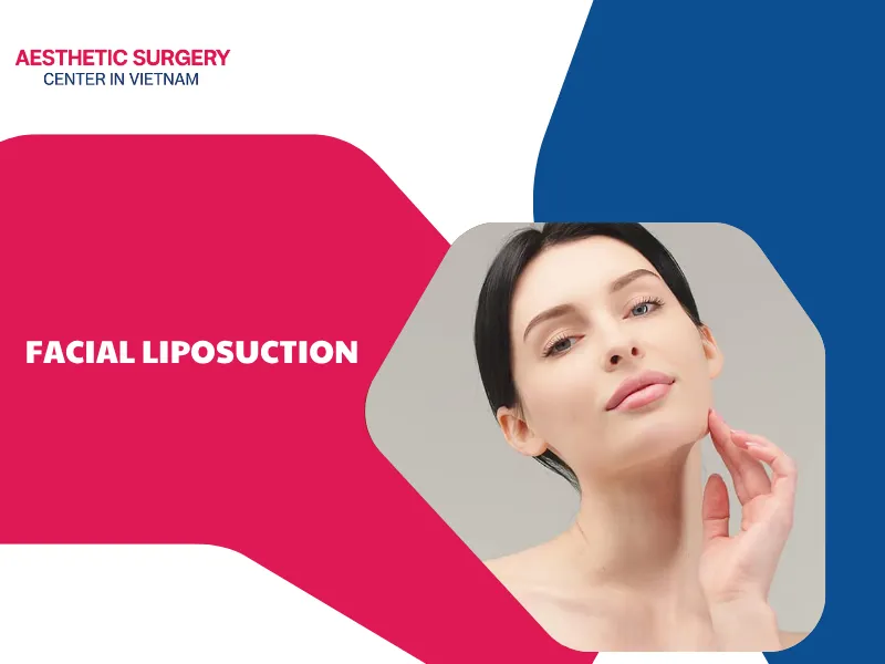 What is facial liposuction? Are you a good candidate?