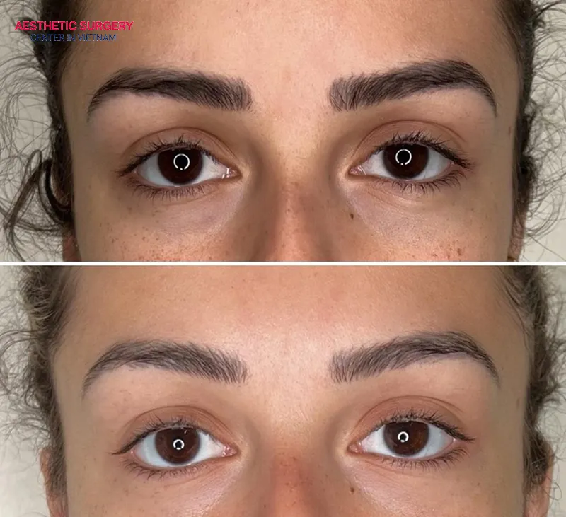 The eyebrows are naturally lifted, making the eyes look bigger and more vibrant.