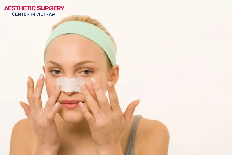 Improper post-rhinoplasty care can lead to bruising of the nose.