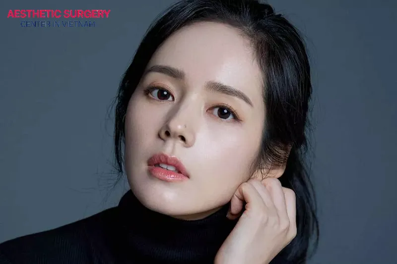 After one month, the nose has fully recovered and is in a beautiful shape