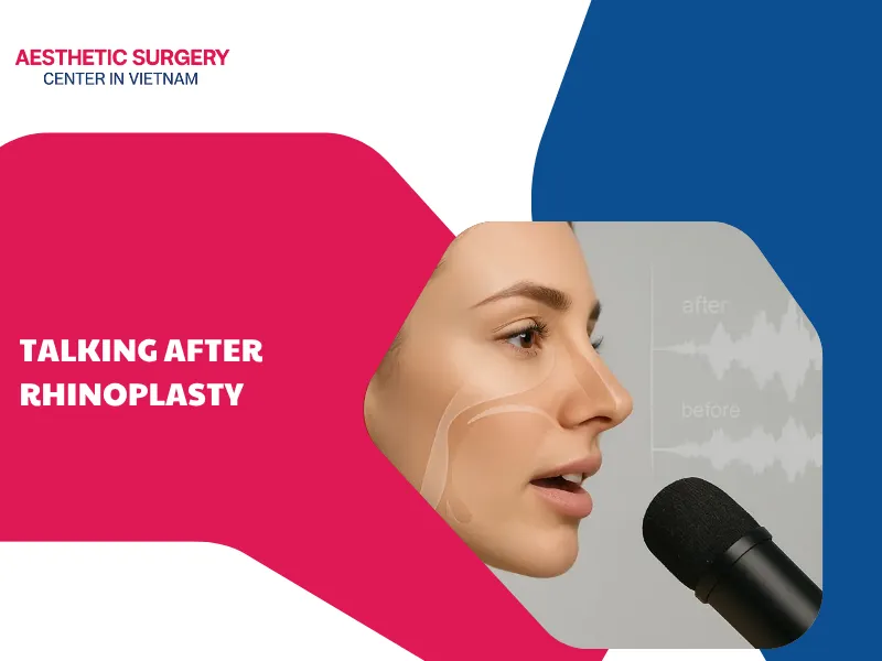 Talking after rhinoplasty: Is it safe and when is it appropriate?