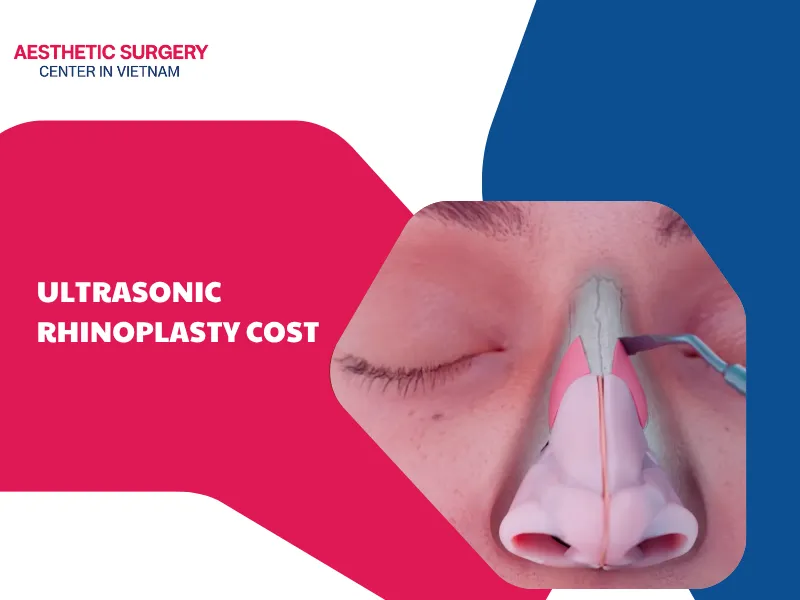 Ultrasonic rhinoplasty costs: Everything you need to know