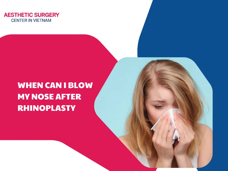When can I blow my nose after rhinoplasty? How to do it right?