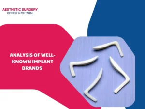 Analysis of well-known implant brands