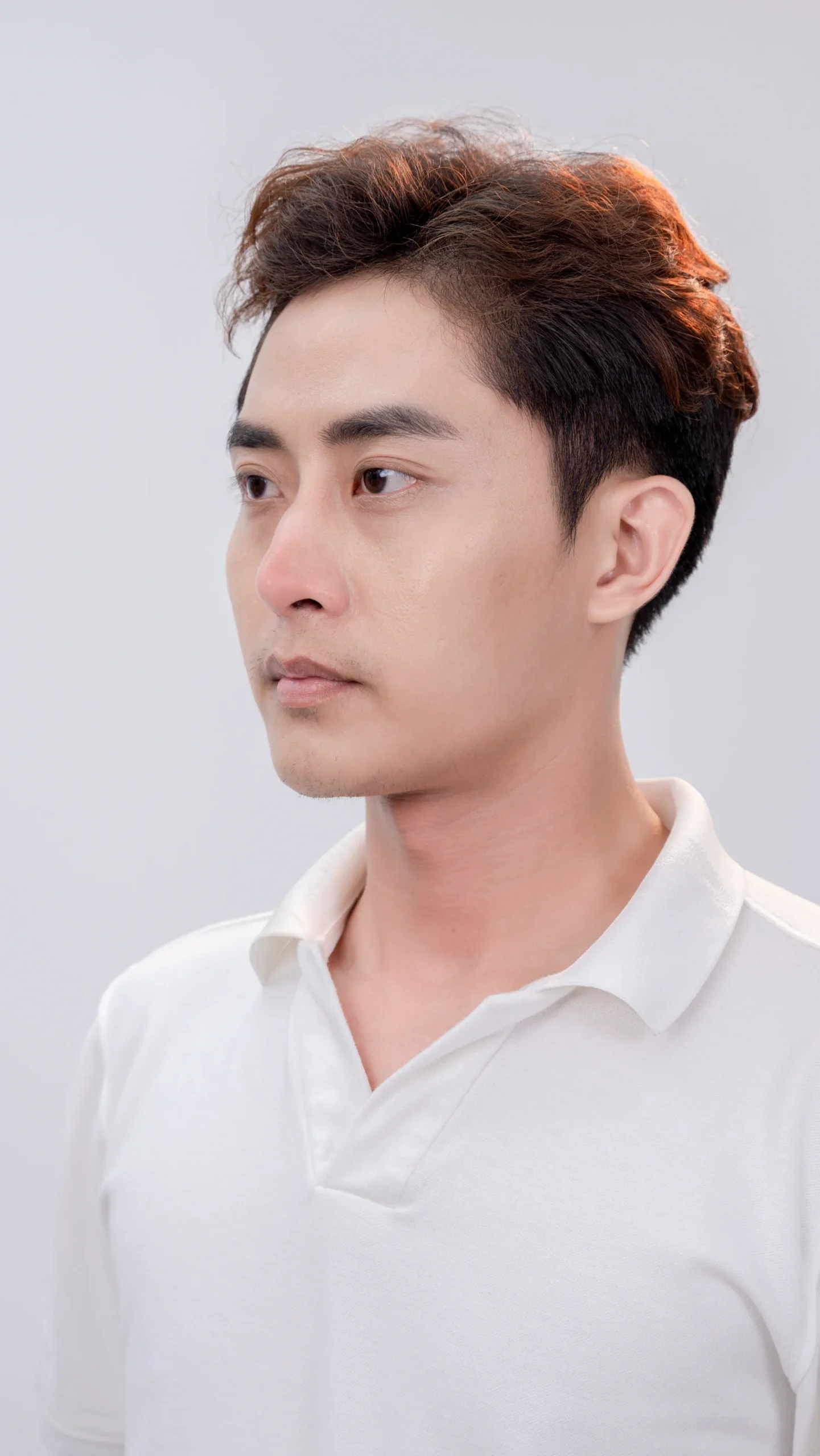 Khách hàng nam trước khi thực hiện thẩm mỹ