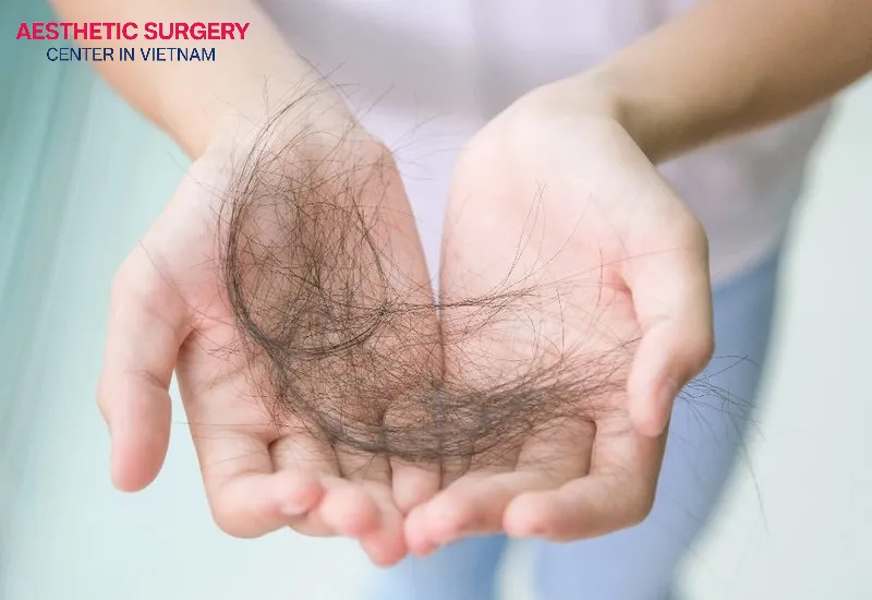 Consuming alcohol after a hair transplant can have the opposite effect, increasing the risk of mass hair loss.