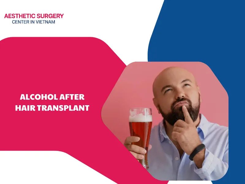 Can I drink alcohol after hair transplant? Important notes