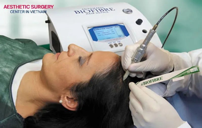 Hair transplant surgery is a gentle, non-surgical procedure