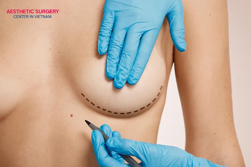 You need to ensure that you are in good health before surgery.
