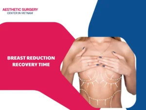 What factors affect breast reduction recovery time? Guide